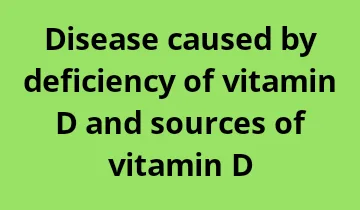 disease caused by deficiency of Vitamin D, which disease is caused by deficiency of Vitamin D, disease caused by Vitamin D, which disease caused by deficiency of vitamin D, best source of Vitamin D, rich source of Vitamin D, the best source of Vitamin D, what are the sources of Vitamin D, good sources of Vitamin D, main source of Vitamin D, natural sources of vitamin a, symptoms of Vitamin D, Vitamin D symptoms.